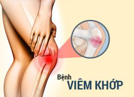 Trị viêm khớp gối, tay, chân
