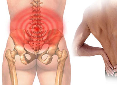 Đau lưng dưới, đau thắt lưng