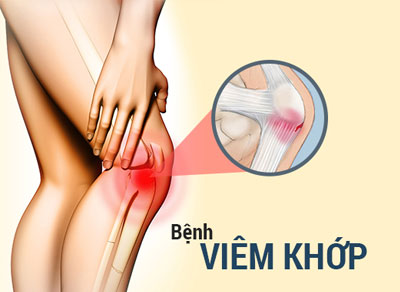 Trị viêm khớp gối, tay, chân